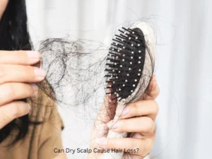 Can a dry scalp cause hair loss?