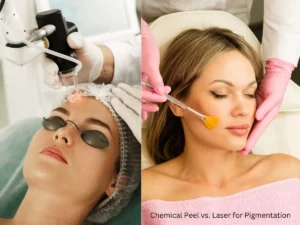 Comparison of chemical peel and laser for pigmentation