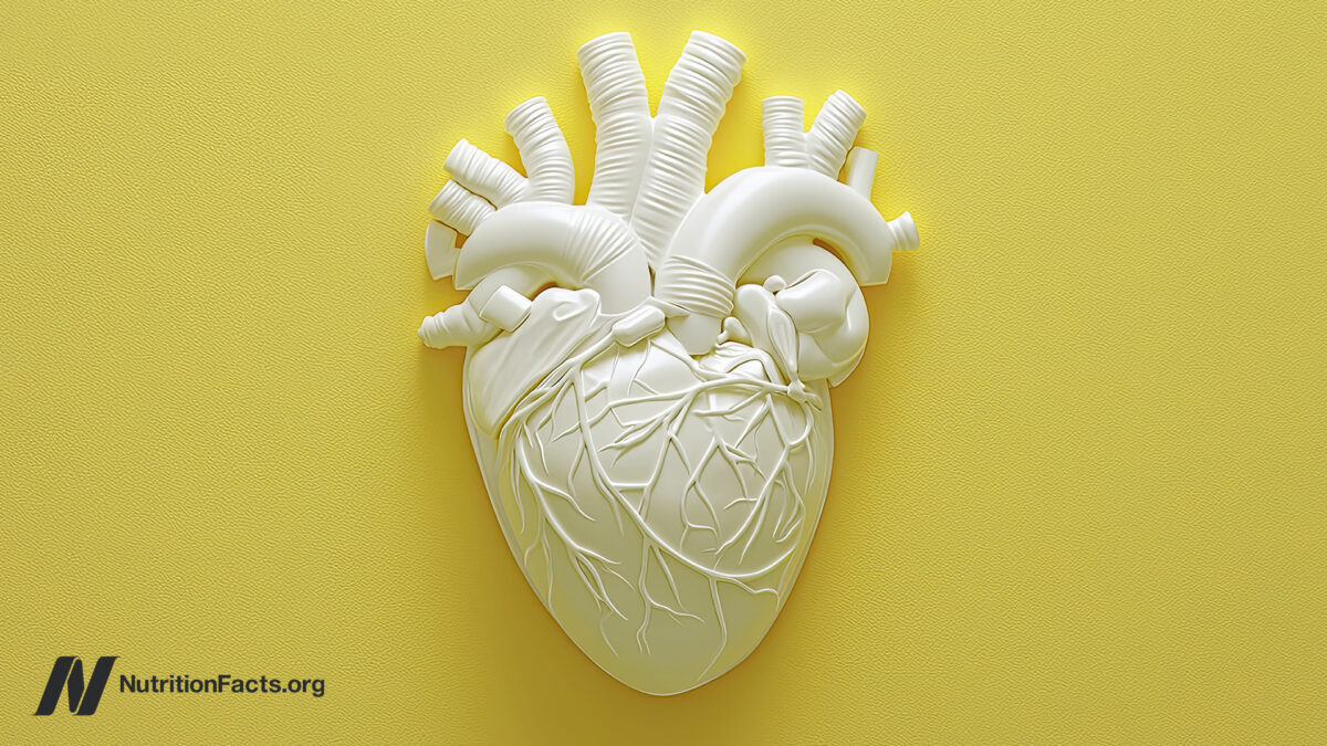 Benefits and Benefits of Angioplasty and Cardiac Stents