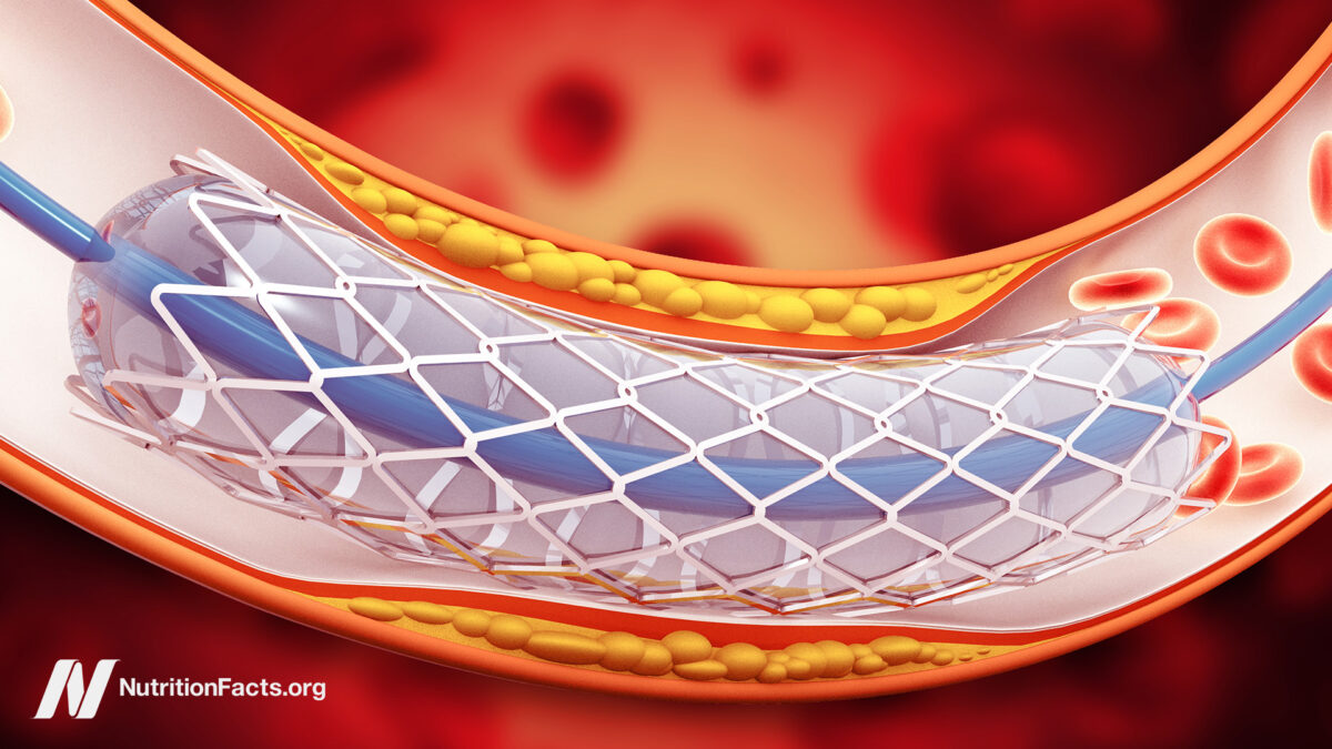 Why use stents when they don't work?