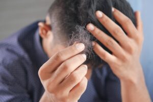 Male Pattern Hair Removal: 3 Treatment Options to Consider