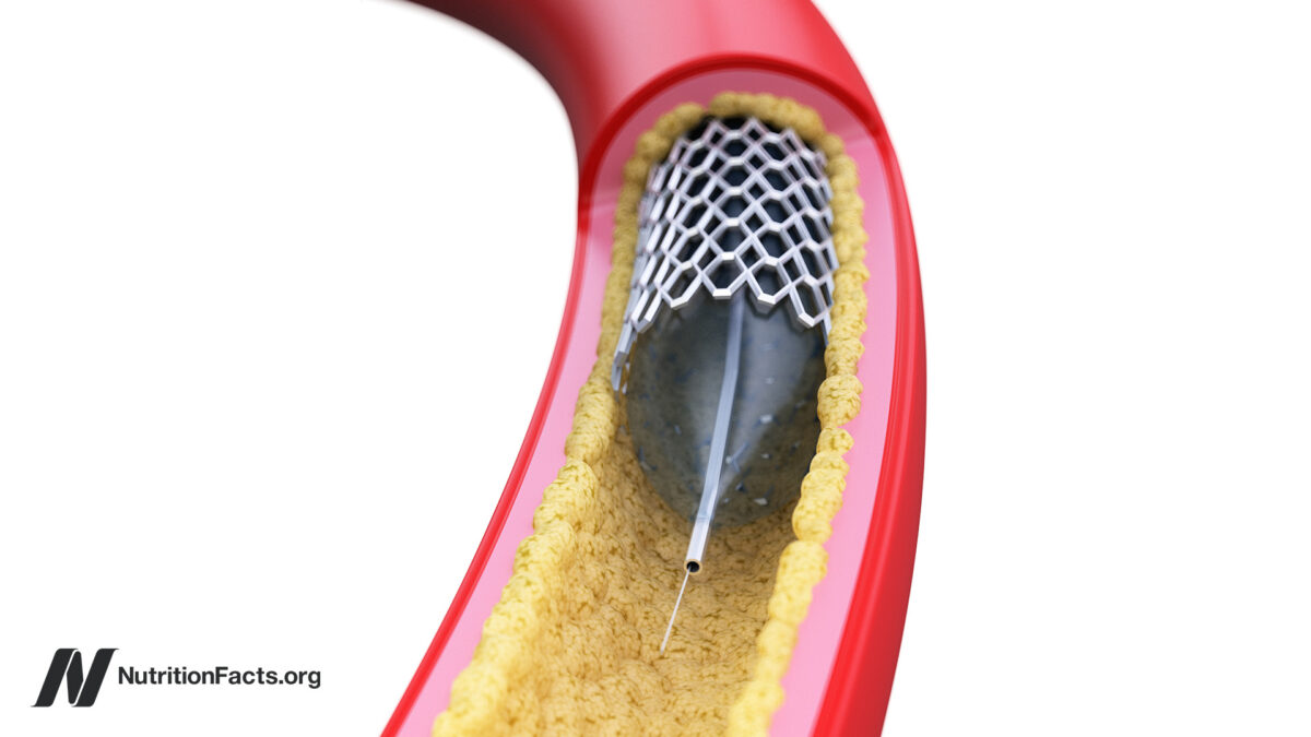 Why are angioplasty cardiac stents less effective?