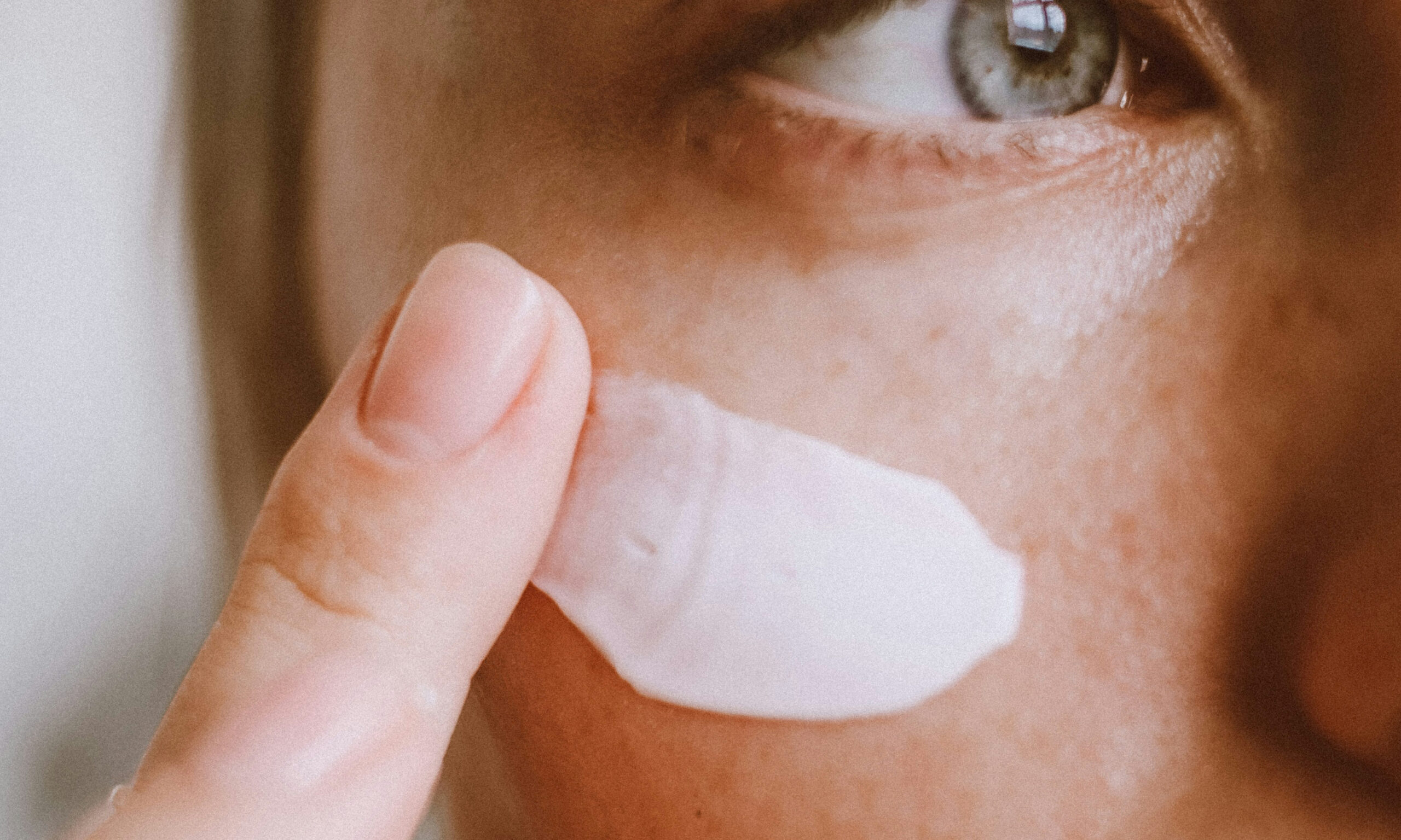 Derm shares top RX solutions for acne