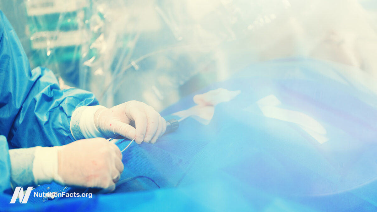 Effectiveness of angioplasty and cardiac stent procedures