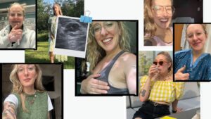 My 10-year journey to grasp my chronic breast pain