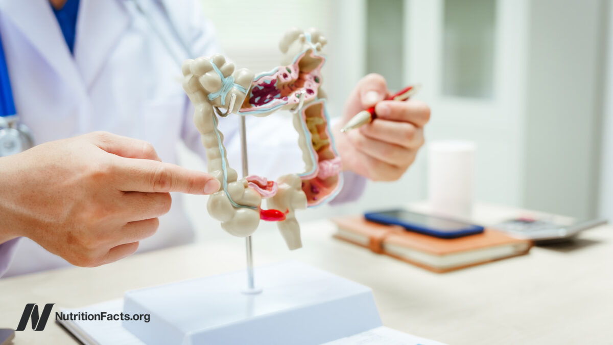 Validity of the SIBO Test