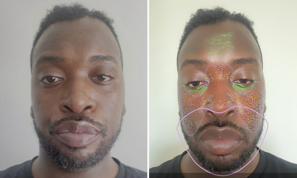 I had an AI diagnose my skin. Here's what was right and what was missing: