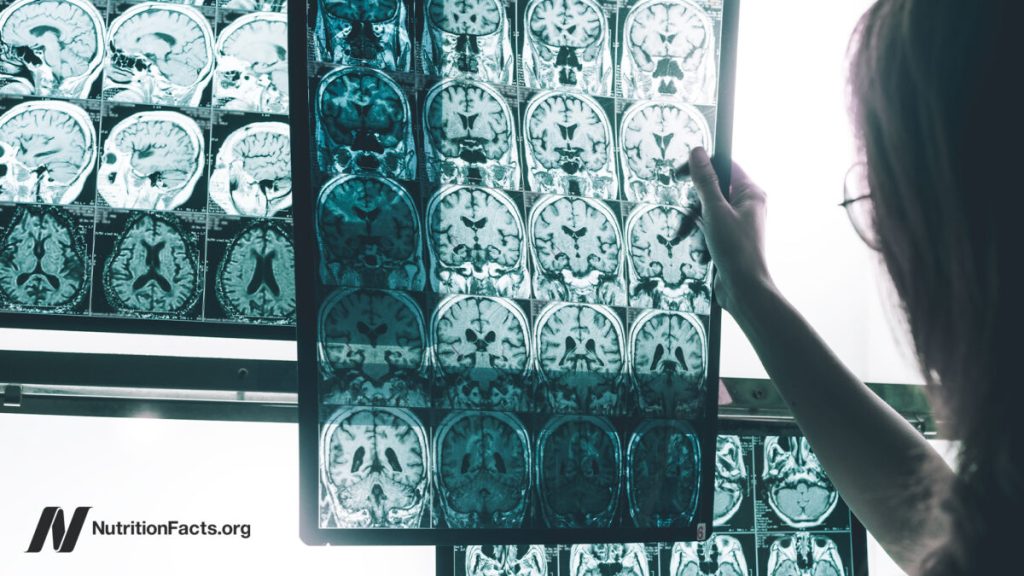 Pesticide residues are linked to Alzheimer's disease risk
