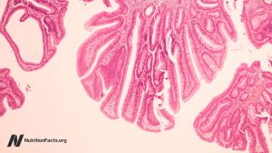 Is it possible that bovine leukemia virus causes breast cancer?